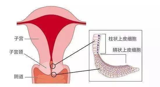 宫颈口肥大需要治疗吗