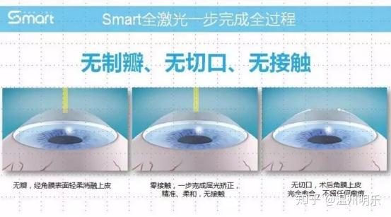 眼科眼底病激光设备种类有哪些